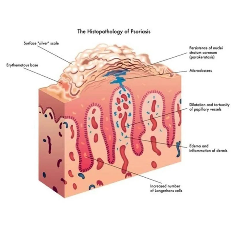 1 шт. обезболивающий крем для лечения травяная мазь ревматоидного артрита боли в