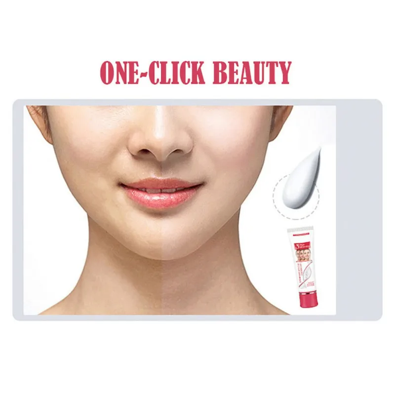 

New Facial Cream Skin Whitening Bright Skin Cream Treat Blemishes Dark Spot Acne Freckles Anti-Acne Dark Spot