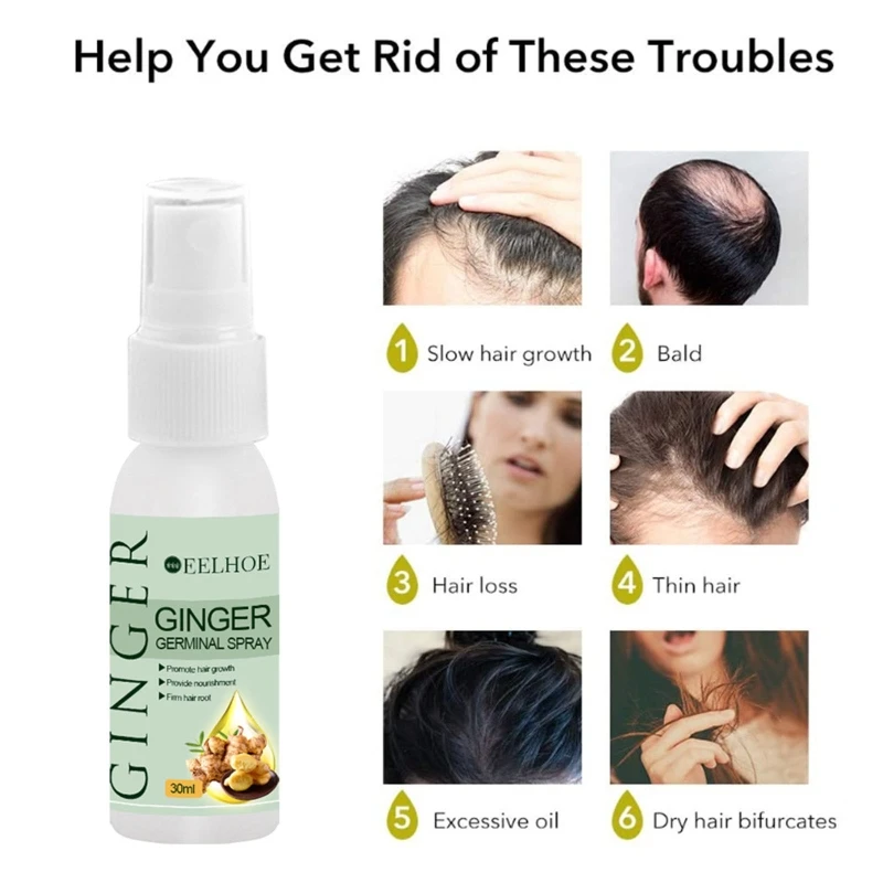 

30ml Ginger Hair Growth Spray Hair Care Hair Loss Products Anti Hair Loss U2JD