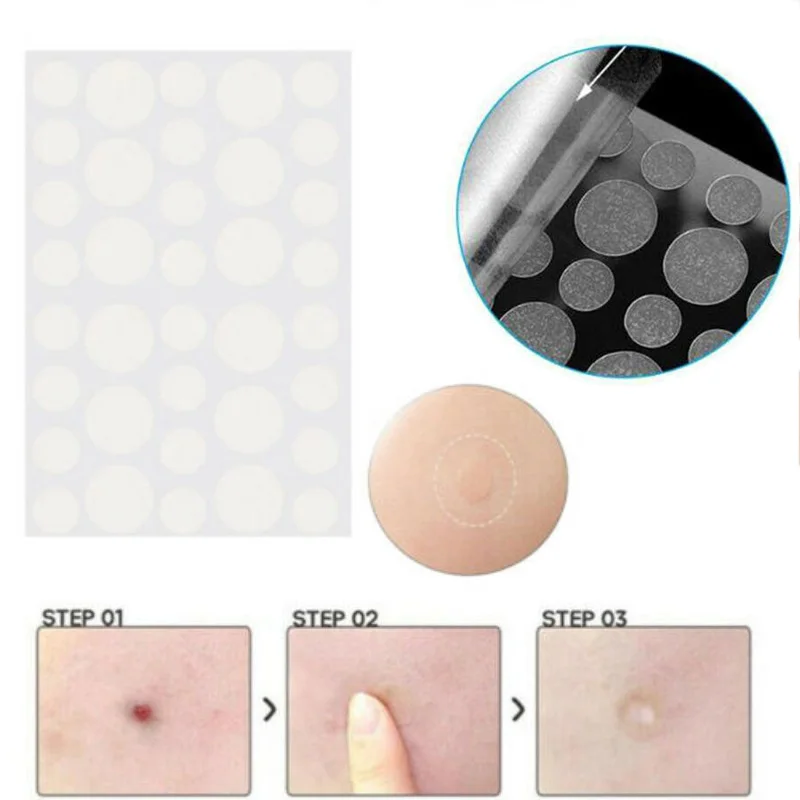 36 шт Гидроколлоидные Патчи от акне Невидимый прыщей кожи тег черных точек патч