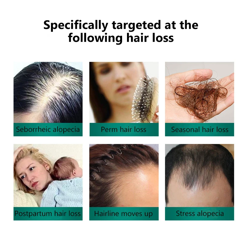 Сыворотка Имбирная для роста волос 7 дней | Красота и здоровье