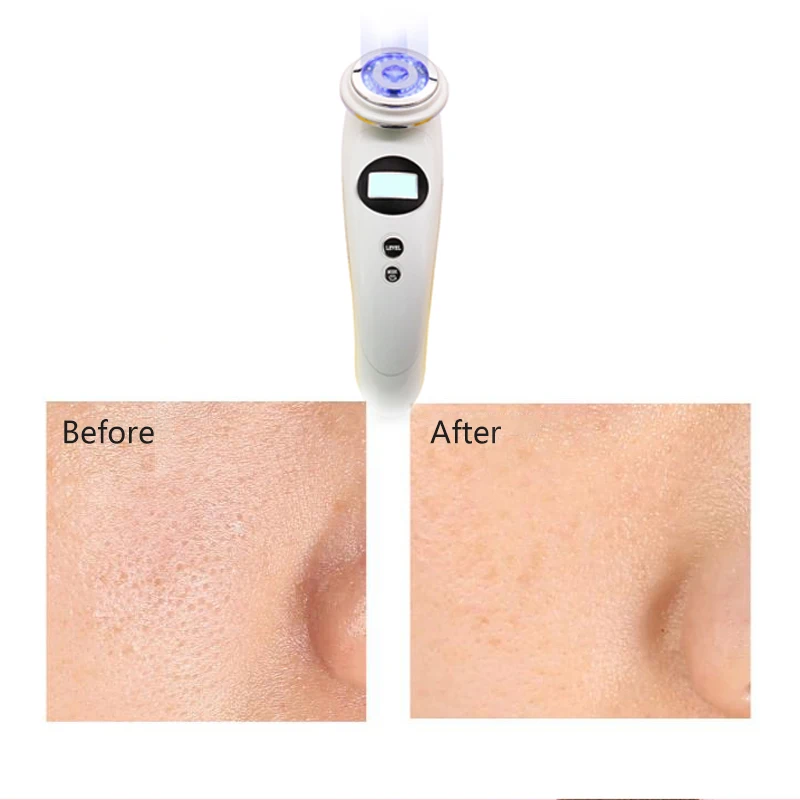 гальваническая для лица 7 в 1 RF фотон лечение кожи красоты Гальваническая EMS