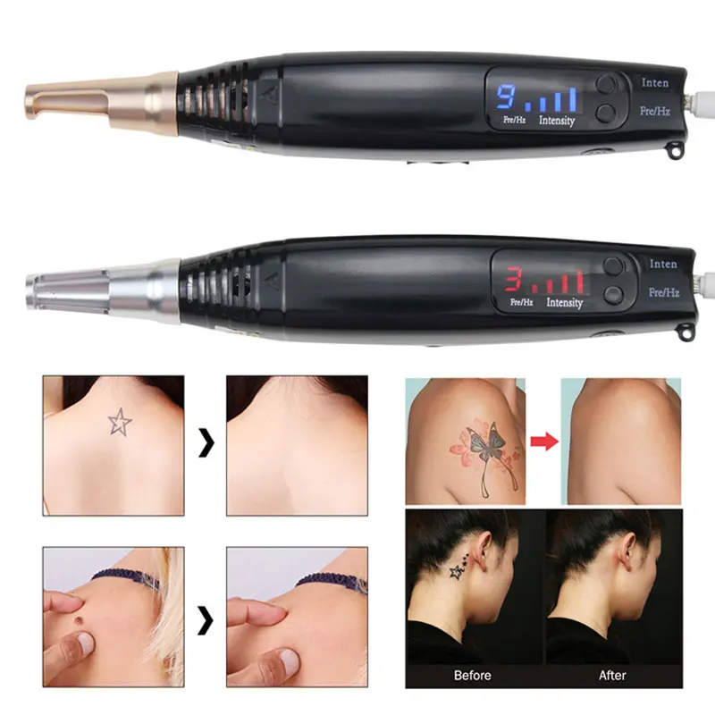 

Blue & Red Skin Tag Dark Spot Remover Laser Pen Tattoo Freckles Acne Removal Machine Laser Picosecond Pen Skin Care Tools