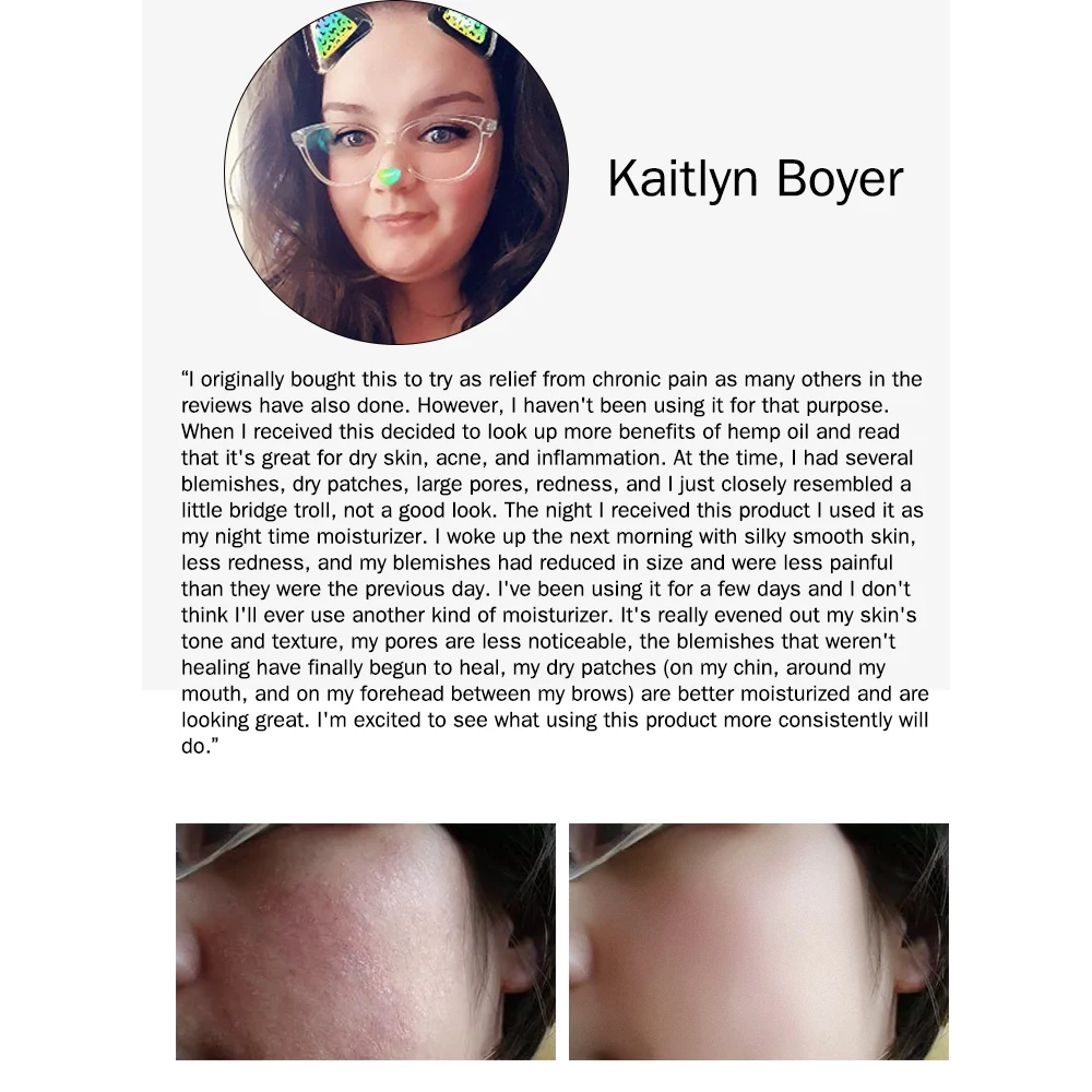 3000 мг органические эфирные масла масло семян конопли травяные капли снимают