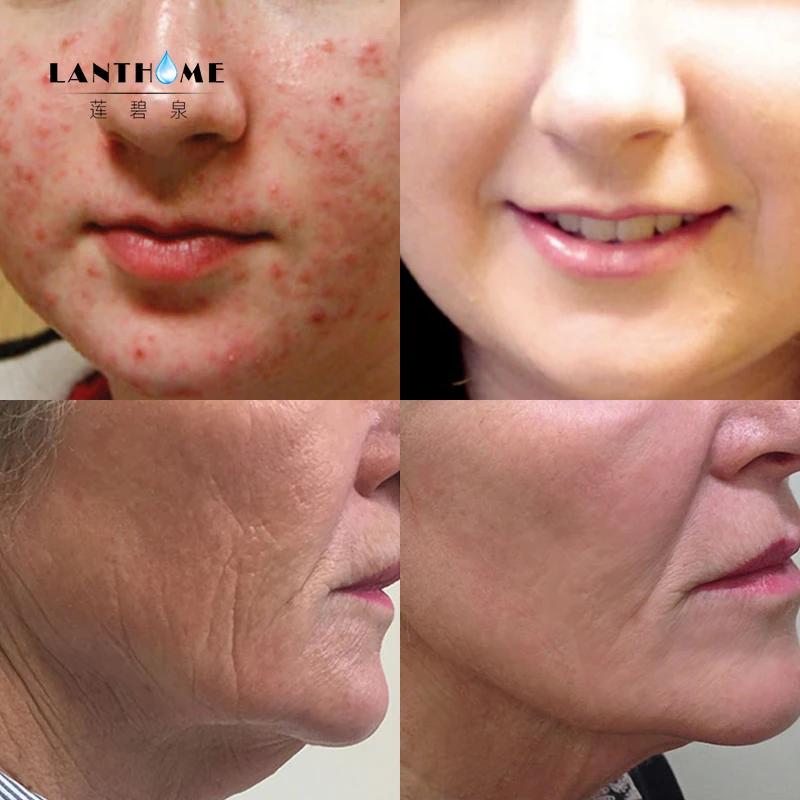 Отбеливающая сыворотка с витамином С гиалуроновой кислотой улиточный крем для