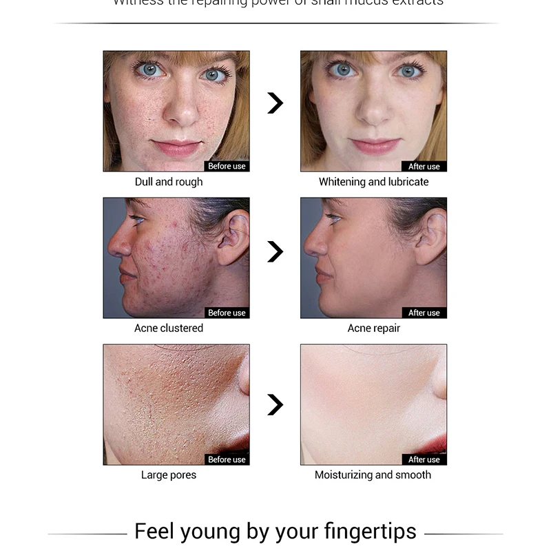 LANBENA 30 г Улитка восстановление и отбеливание крем для лица дневной против морщин