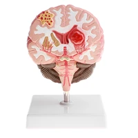 anatomical humans brain disease pathological model medical teaching tool lab display model education humans brain model