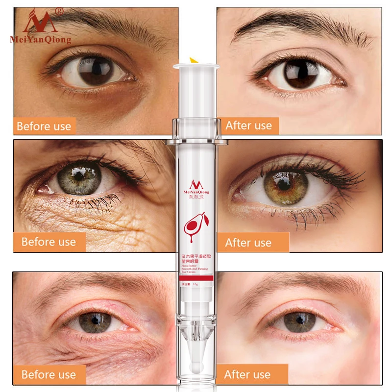 Крем для кожи вокруг глаз увлажняющий восстанавливающий|firming eye cream|eye creamdark circles |