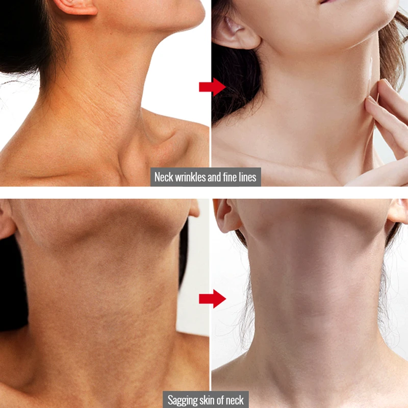 5 шт. отбеливающий питательный крем для области шеи|Шея| |