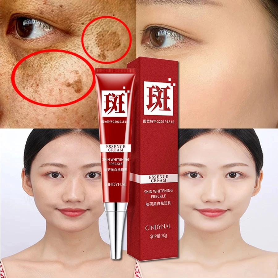 

20g Whitening Freckle Cream Remove Melasma Pigment Melanin Dark Spots Pigmentation Moisturizing Gel Skin Care