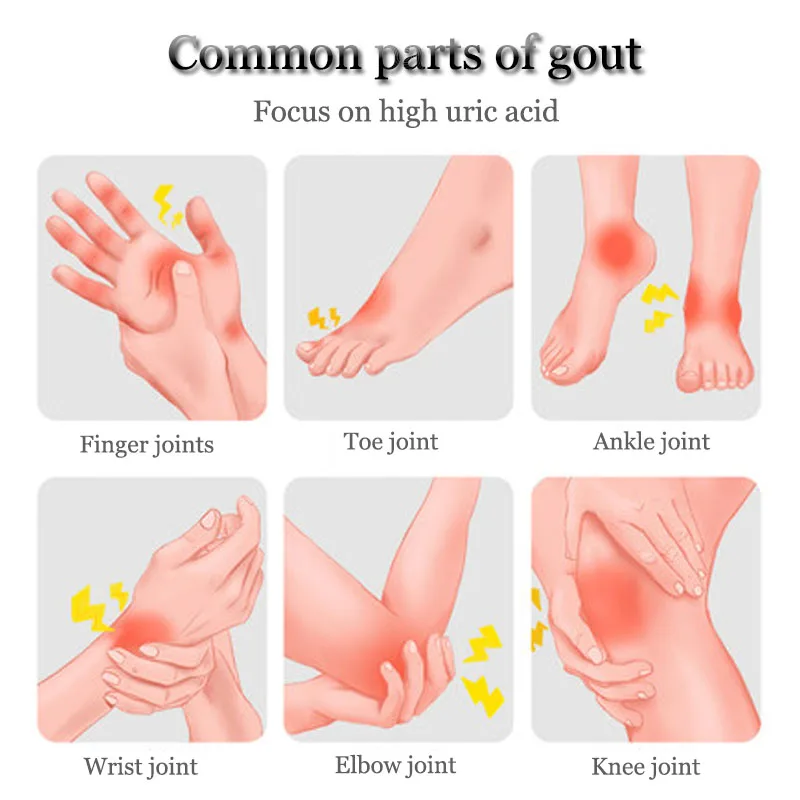 

Reduce Blood Uric Acid Balance Tea for Gout Treatment Joint Pain Edema Inflammation Fatreducing Detox Natural herbal medicinetea