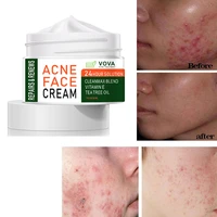 vova acne removal cream effective treatment fade acnes spots oil control shrink pores whitening moisturizing face skin care 30ml