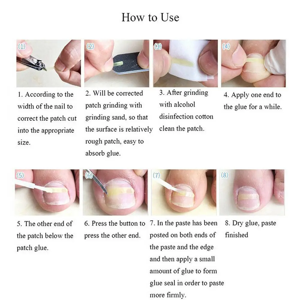 

10pcs/set Ingrown Nail Pad Ortho Nail Filling Nail Nail Ingrown Groove Artifact Ingrown Nail Corrector Pad B2V6