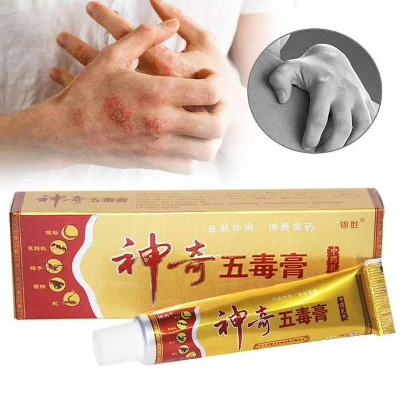 

Травяной псориаз зуд крем дерматит Eczematoid экзема мазь для лечения псориаза крем по уходу за кожей крем