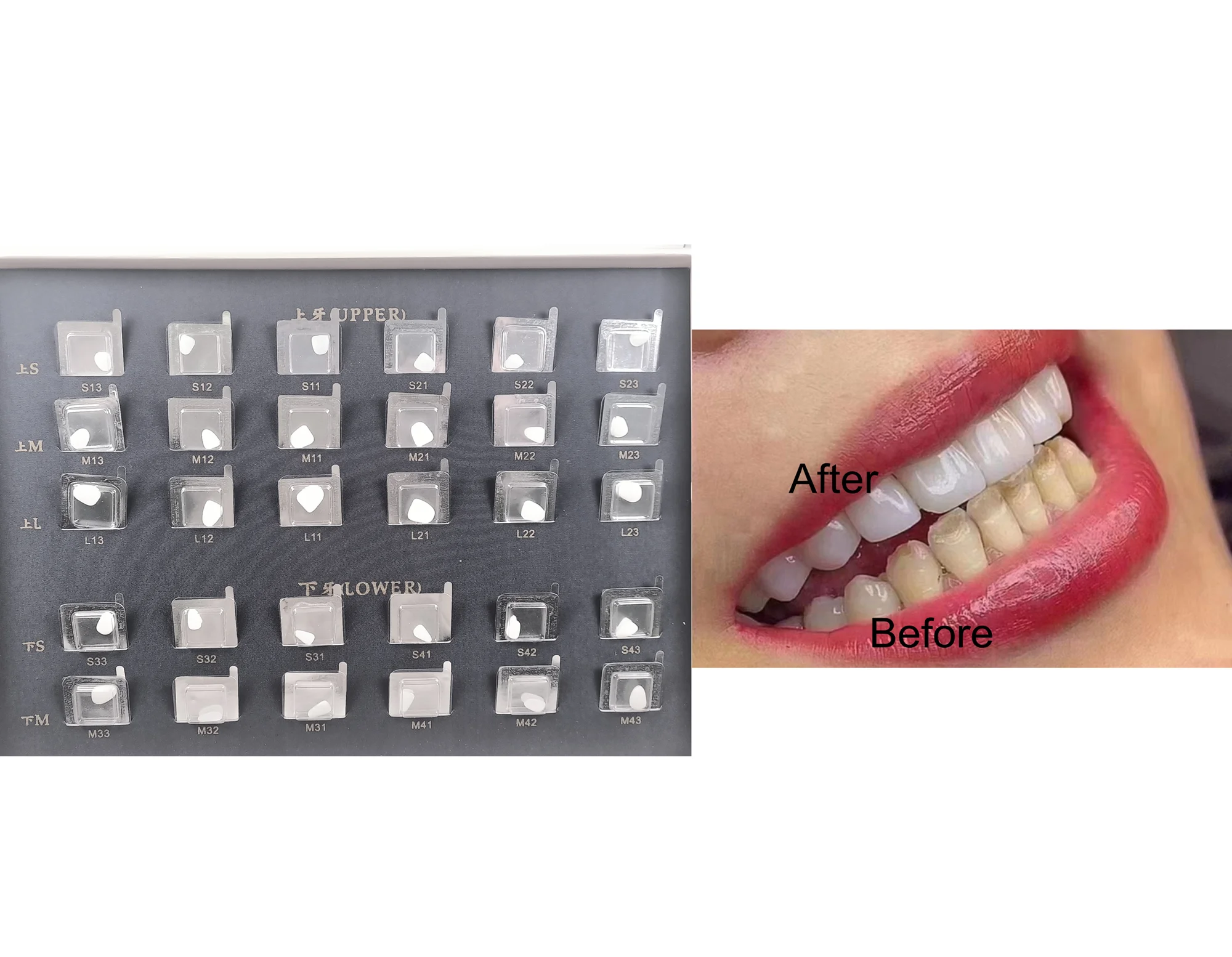 

Super Model of Tooth Whitening Composite Porcelain Veneer Free of Mould Pre Forming 30 Tooth Patches