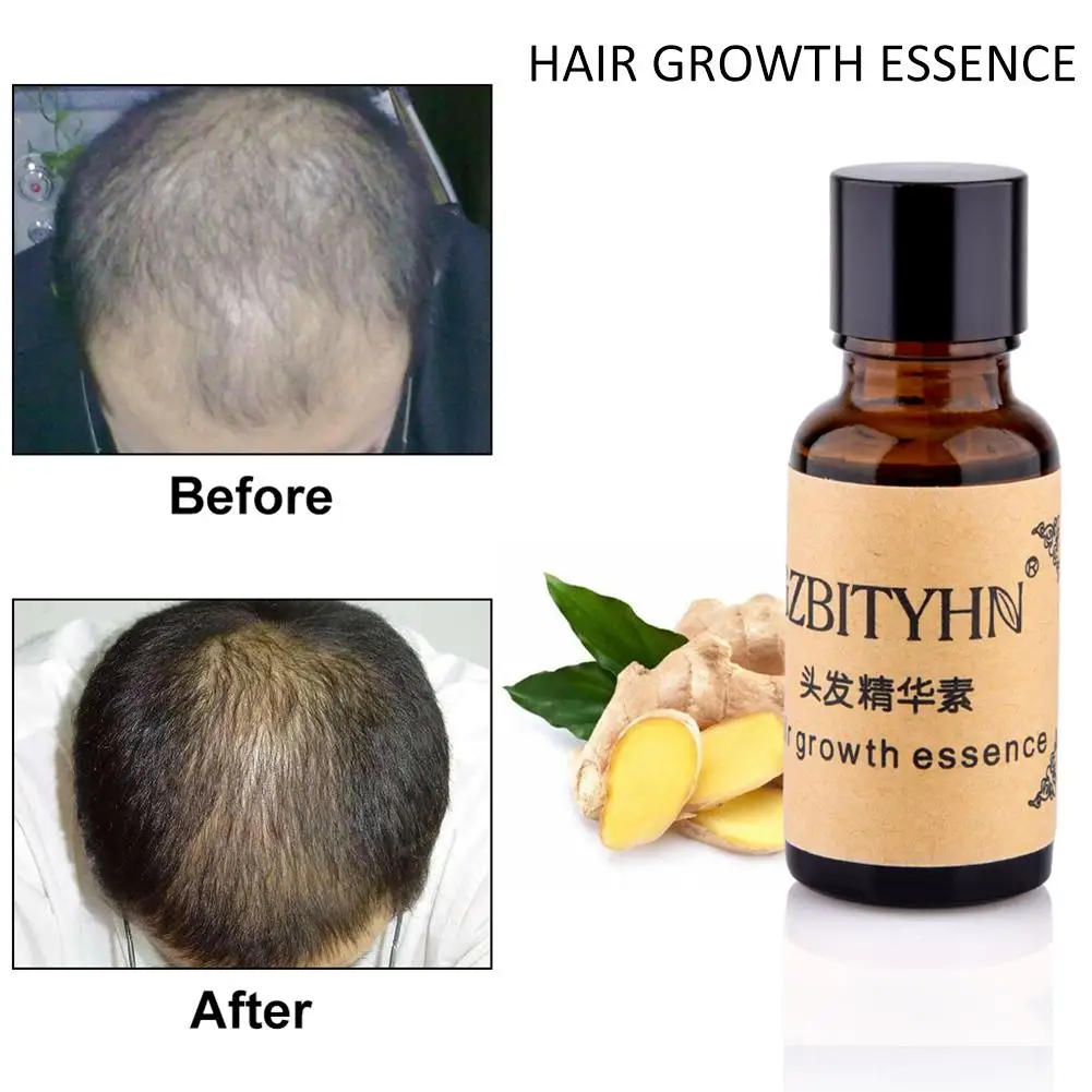 Эссенция для роста волос против алопеции питательная Увлажняющая Жидкость