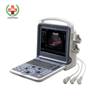 sy a042n full digital color doppler ultrasound diagnostic system 4d color doppler ultrasound price