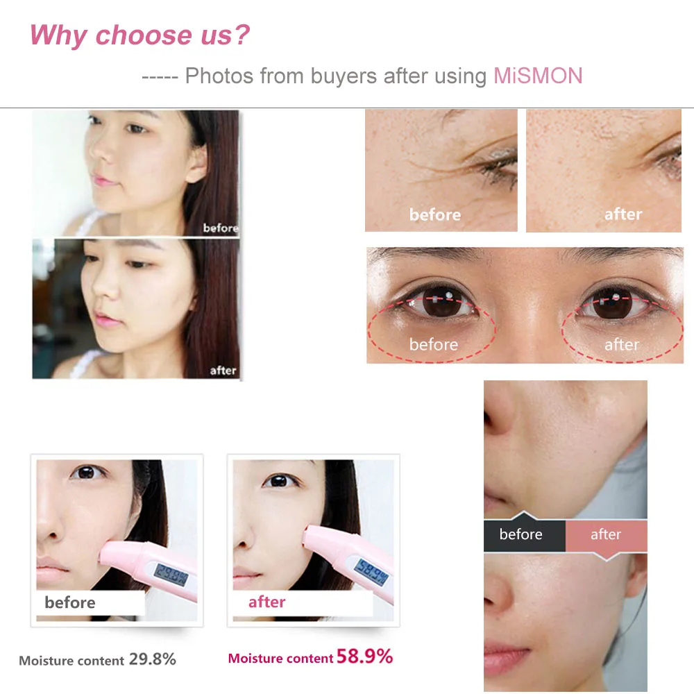 

306C Beauty Machine 5 IN 1 RF EMS LED Mesotherapy Skin Care Tool Facial Photon Rejuvenation Anti-aging Lift Face Massager