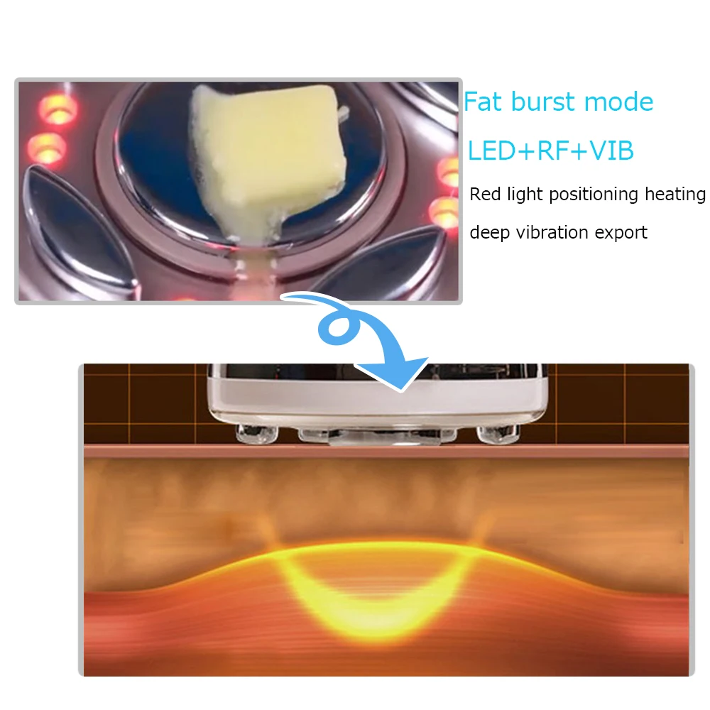 Ультразвуковой массаж CV RF антицеллюлитный массажер эмагрисер кавитацион