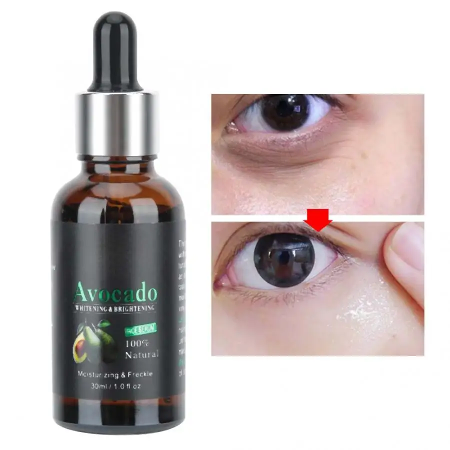 30 мл Aichun натуральный масло ши увлажняющий лифтинг тонкая линия удаление