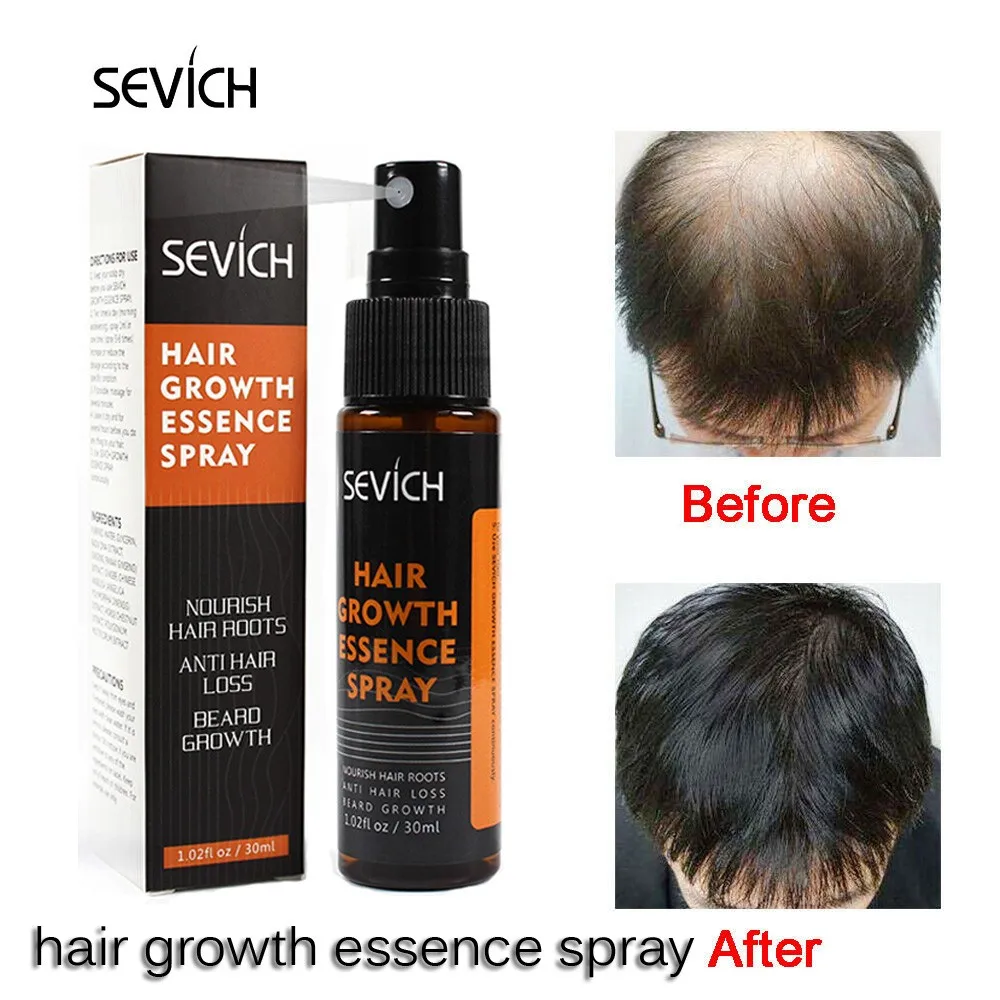 Эссенция для быстрого роста волос масло лечения выпадения помощь эссенция спрей