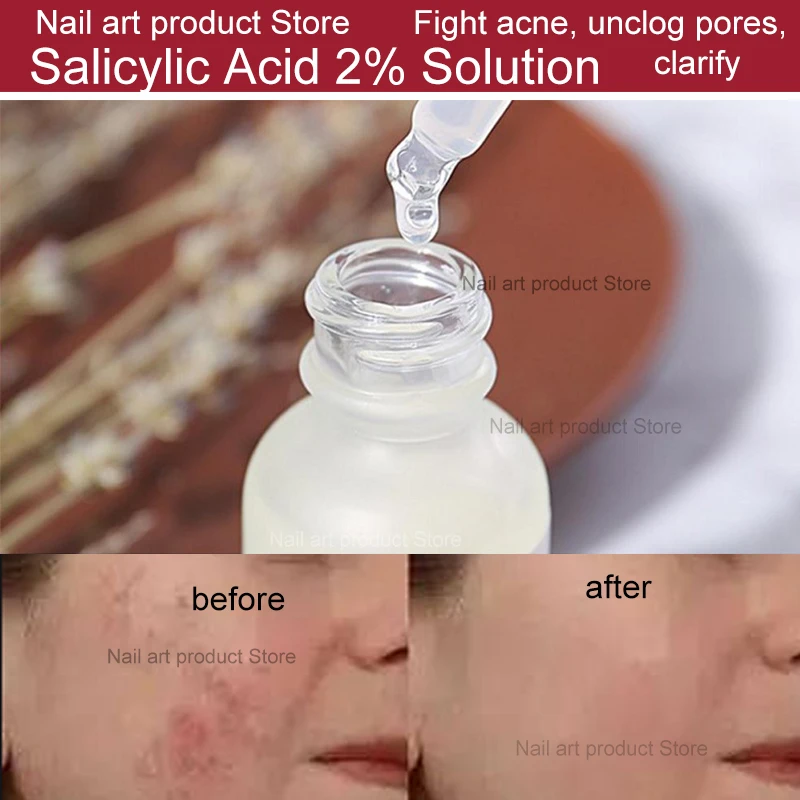 

Ordinary Niacinamide 10% + Zinc 1% High Mineral Essence Moisturizing Fade Acne Spots Regulates Sebum Minimizes Pores Skin Care