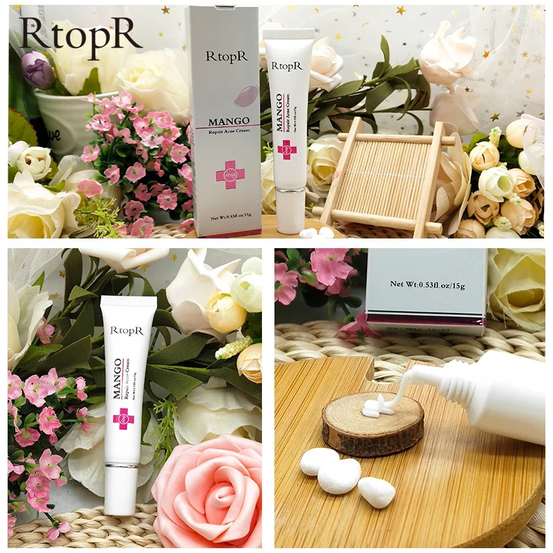RtopR для лечения прыщей крем удаления черных точек ремонт гель Удалить уменьшение