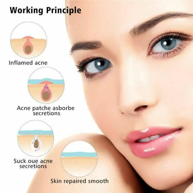 36Pcs Hydrocolloid Acne Invisible Pimple Master Patch Skin Tag Removal Patch Pimple /Blackhead Blemish Removers Facial Care Tool