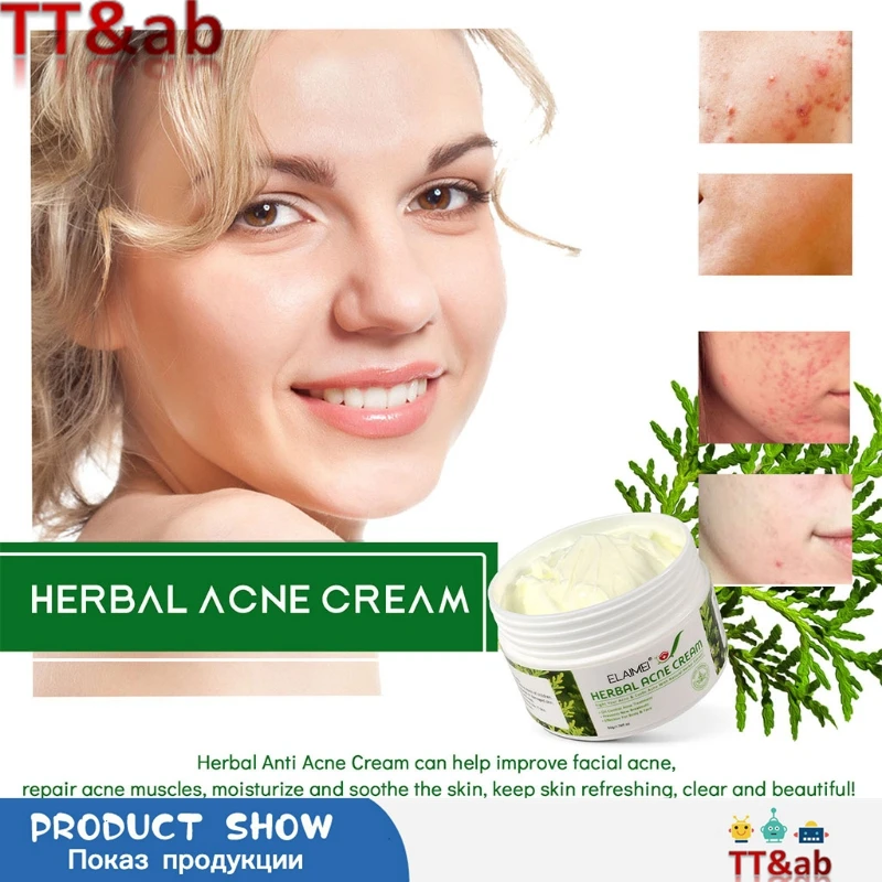 

2021 New Acne Cream Acne Cream Acne Face Cream Blackhead Repair Gel Oil Control Shrink Pores Scar Moisturizer Skin Care