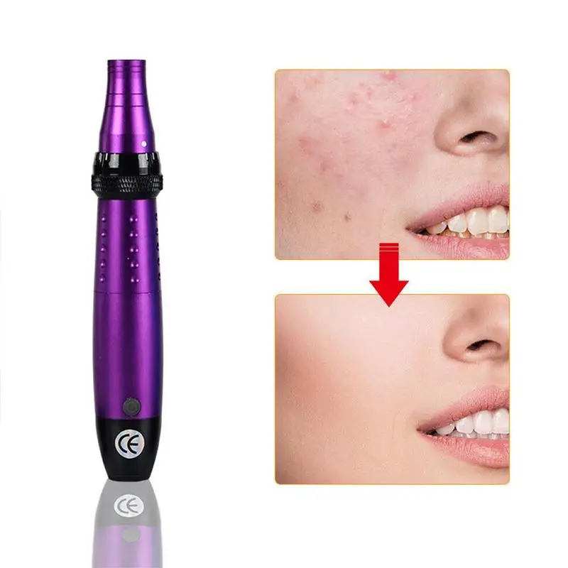 TMS электрические нано Авто Дерма микро иглы с 12 штемпель ручка удалить шрам