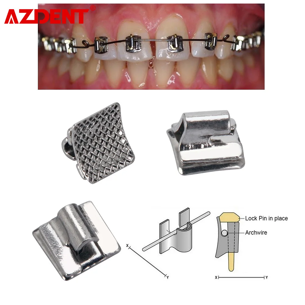 

100 шт./пакет AZDENT 3w-u-другой кронштейн, плоская Стоматологическая Ортодонтическая молярная лента Archwire Niti, эластичная катушка