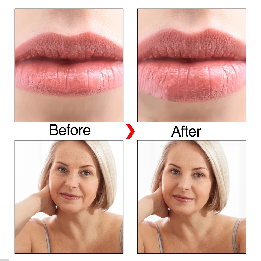 Гиалуроновая ручка Meetcare