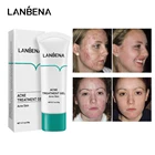 Крем для лица LANBENA для лечения акне, восстанавливающий гель для удаления шрамов, черных точек, прыщей, контроль жирности, сужение пор, отбеливание, уход за кожей