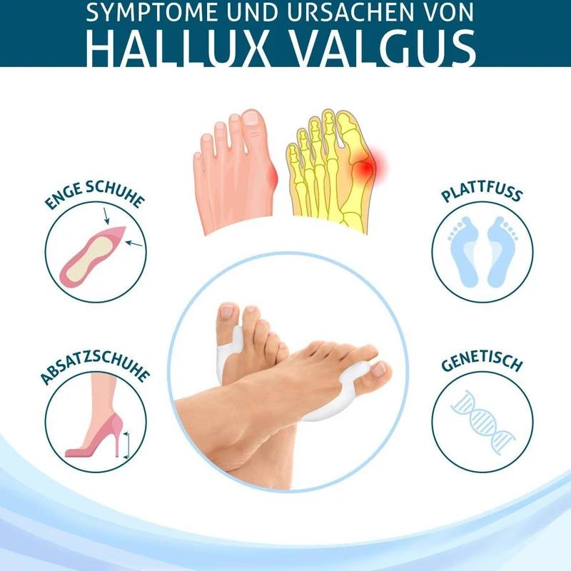 1 пара BYEPAIN Стандартный Bunion Pad & Toe Spacer Set Corrector силиконовый гель Hallux Valgus Relief
