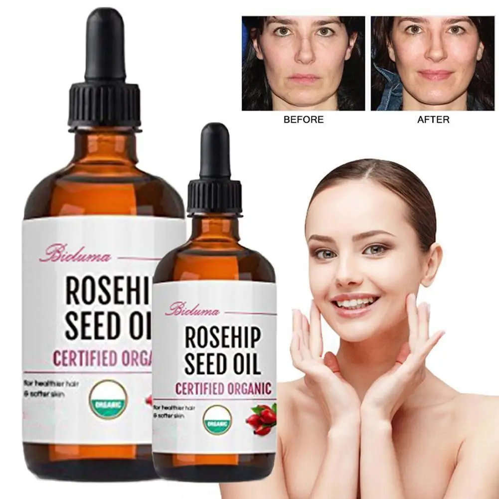 

10ml/30ml Rosehip Oil Pure Natural Organic Essential Oils Moisturizing Brighten Massage Oil Anti-Dry Anti-Aging Face Essential