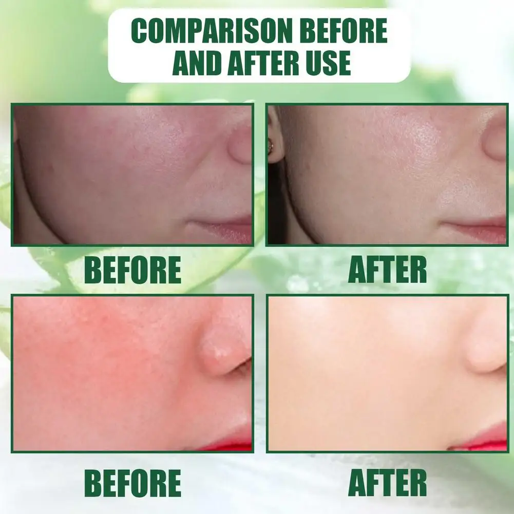 Aloe Vera Essence Sunburn Soothing Repairing Moisturizing Spray Improve Rough Skin Sooth Skin Face Care Liquid Toner Spray