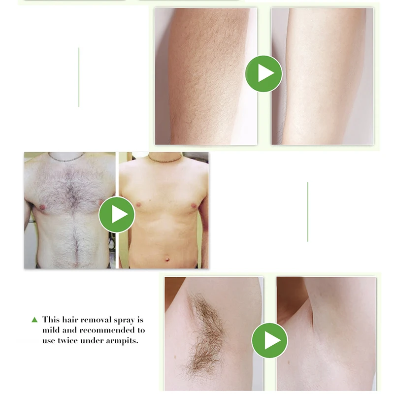 

Hair Removal Spray Fast Legs Arms Underarm Body Painless Hair Remover for Men Women J9