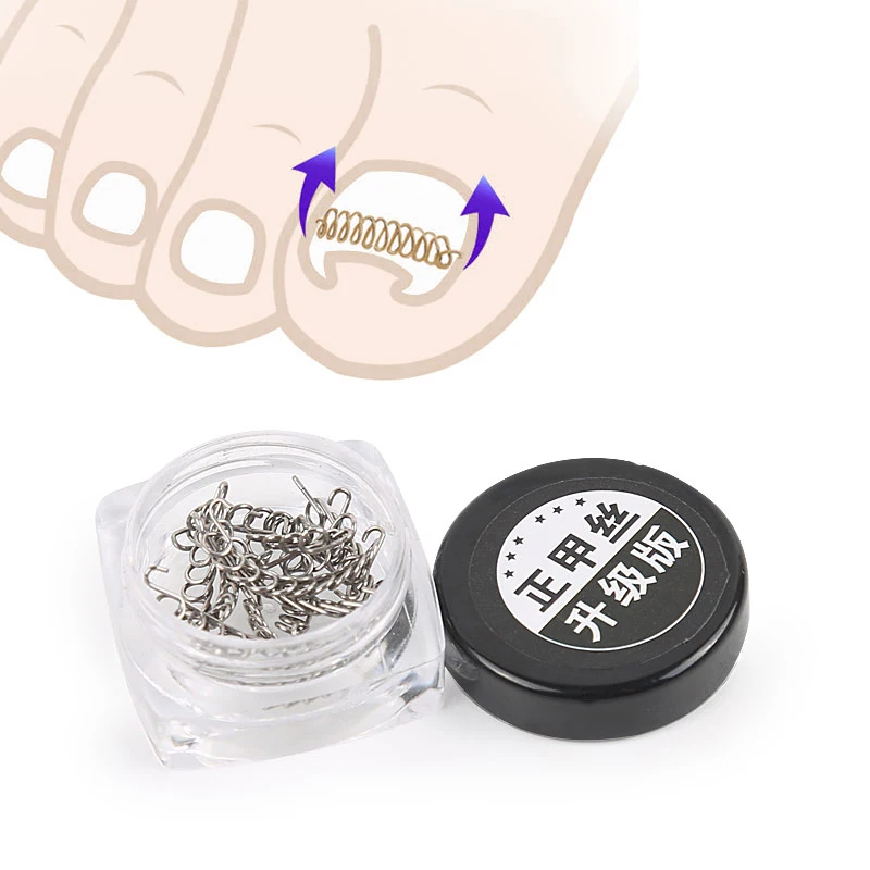 12 шт. Инструменты для ремонта вросших ногтей Ортодонтическое приспособление