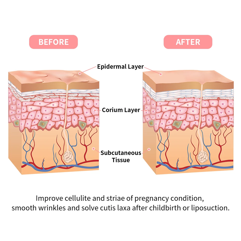 Beste Rf Led Ultrasone Cavitatie Lichaam Afslanken Stimulator Machine Gezicht Lifting Verjonging Vet Brander Verstevigende Apparaat Anti Cellulite
