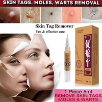 skin tag remover medical papillomas removal of warts liquid from skin tags removing against moles remover anti verruca remedy