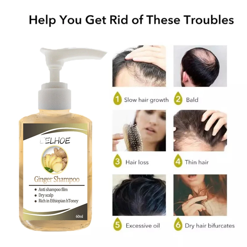 

60ml / 100ml Ginseng Anti-Hair Loss Shampoo Powerful Treatment Essence Herbs Ginger Cooler Hair Growth Lotions for Men Women