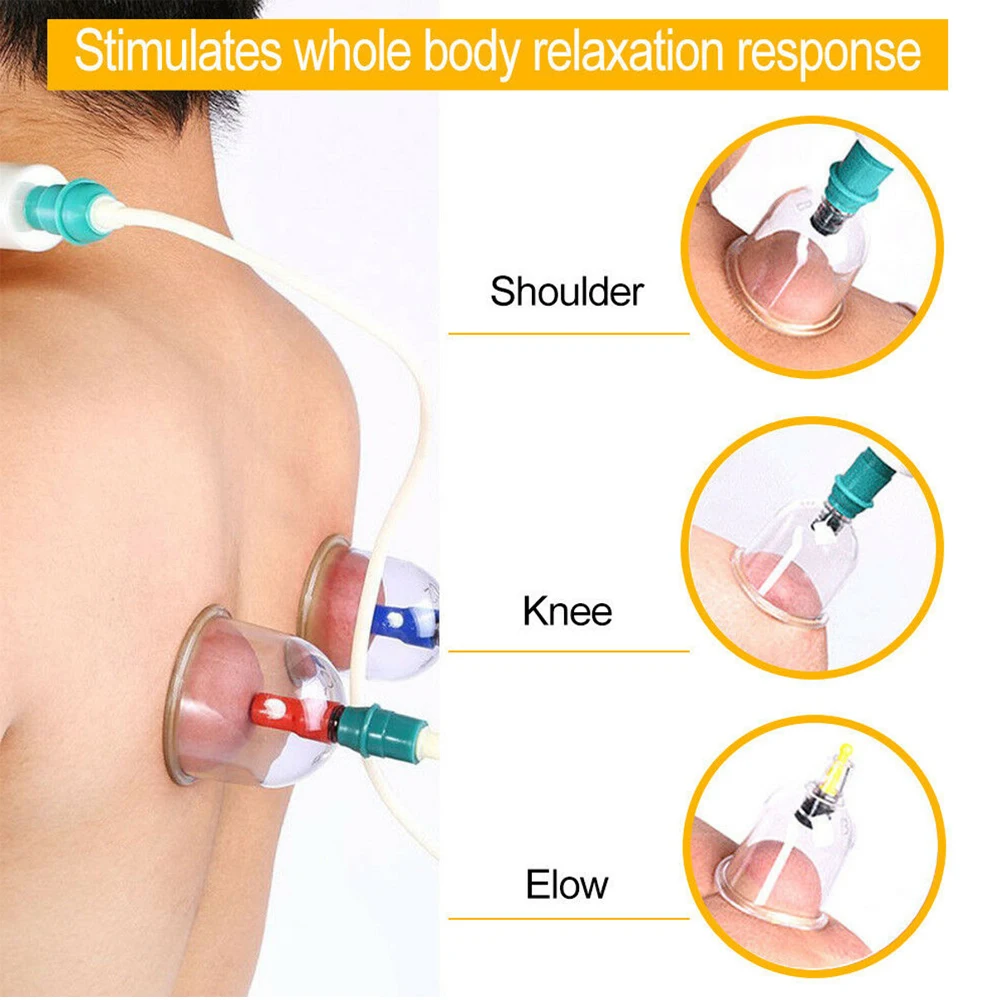 Баночный массаж чашка для терапии комплектов Hijama китайская Акупунктура с
