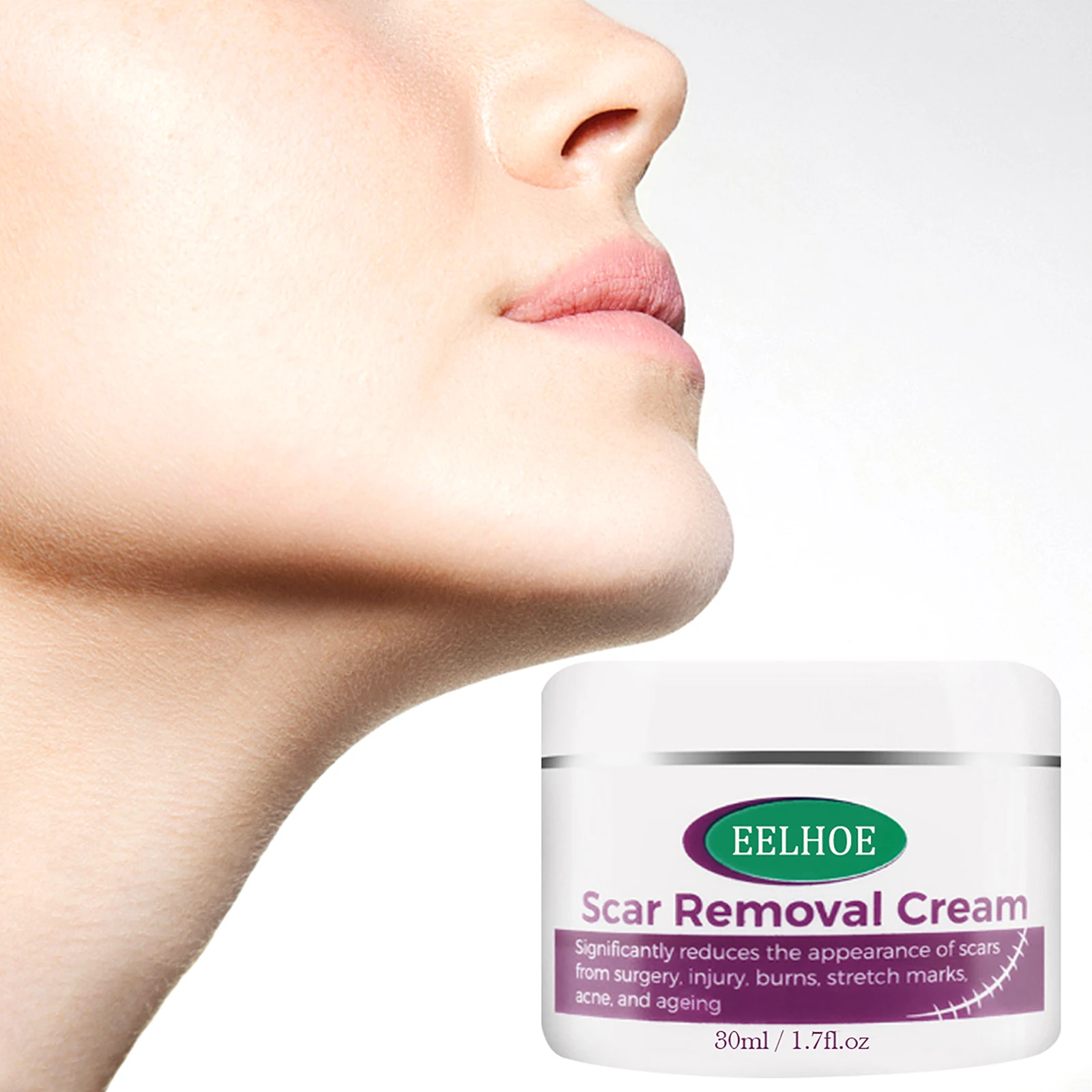 

30g Acne Scar Removal Cream Pimples Stretch Marks Face Gel Remove Acne Smoothing Whitening Moisturizing Body Skin