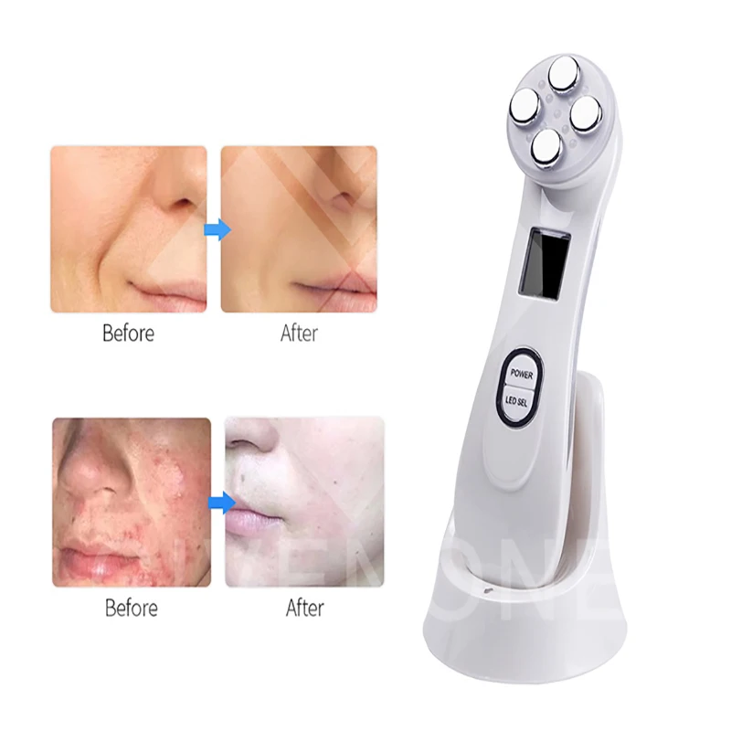 

Electroporation Beauty Instrument Skin Care Face Massager Led Photon Device Radiofrecuencia Facial For Skin Tightening Lifting