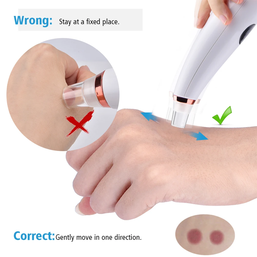 Перезаряжаемый пылесос для удаления угрей ухода за кожей очищения пор с ЖК