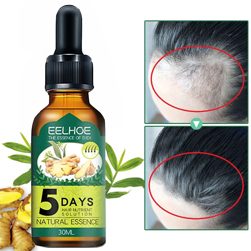 Средство от выпадения волос натуральное|Средства волос| |