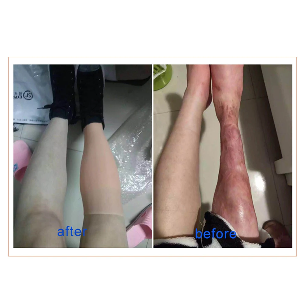 Силиконовый протез рукав для ног искусственная кожа искусственный силиконовый