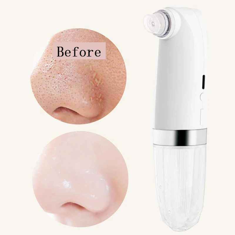 Электрический вакуумный пылесос с маленькими пузырьками устройство для