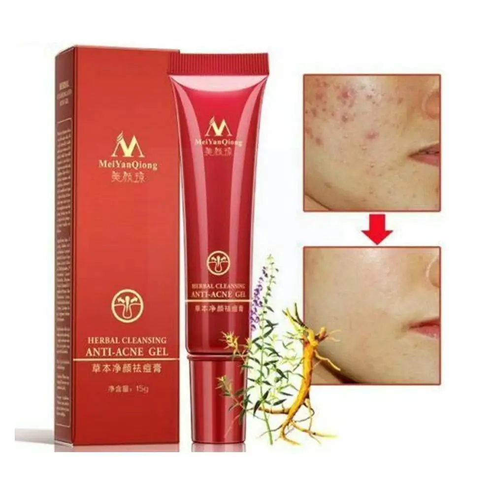 

Effective Acne Removal Cream Herbal Anti-acne Repair Moisturizing Gel Oil Face Whitening Fade Acne Control Skin Care Spots G5E0