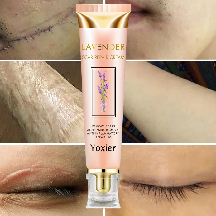 Крем для восстановления шрамов лаванды восстанавливающий шрамы от ожогов